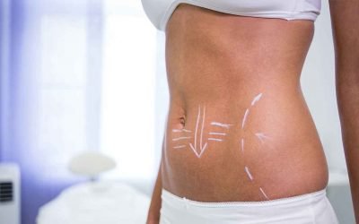 Economic liposuction: the risks