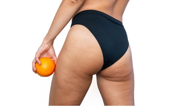 Fitness and Cellulite_ Some Tips - youwillfit