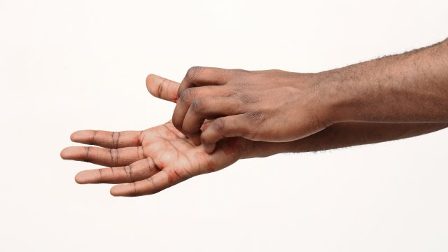 Itchy Palms: Causes and remedies - youwillfit